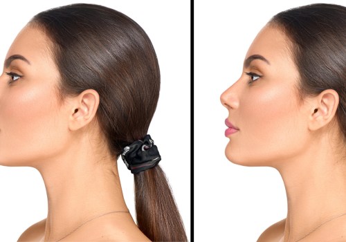 The Most Painful Plastic Surgeries: An Expert's Perspective