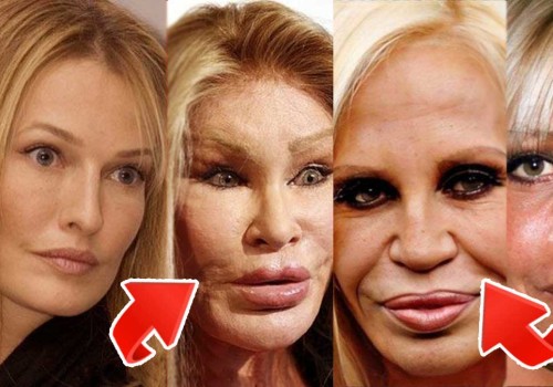 The Truth About Plastic Surgery: An Expert's Perspective