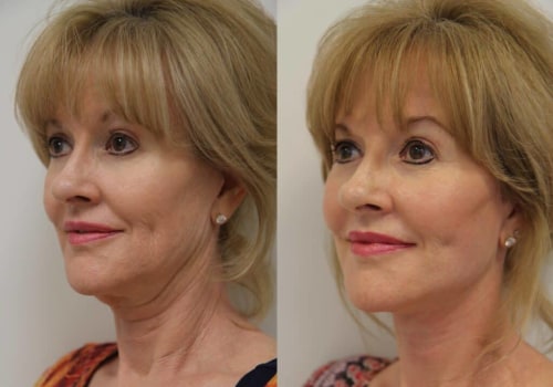 The Most Popular and Effective Plastic Surgery Procedures