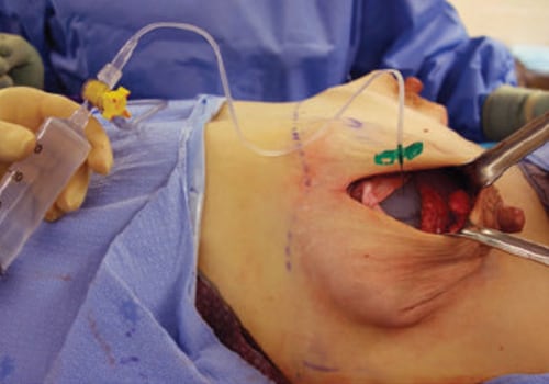 The Art and Science of Plastic Surgery: A Surgeon's Perspective
