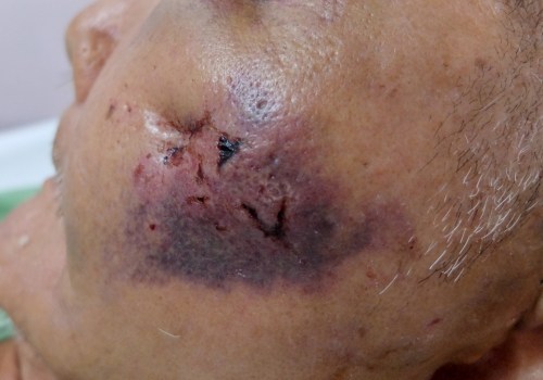The Dangers of Plastic Surgery: An Expert's Perspective